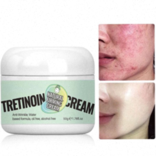 tretinoin cream